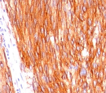 CD117 Antibody [C117/370]