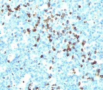 IGL Antibody