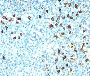 IGL Antibody