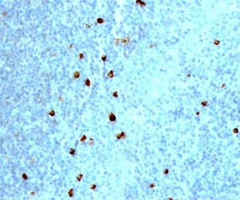 IgM Heavy Chain Antibody [IM373]