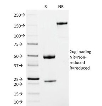 IgM Heavy Chain Antibody [IM373]