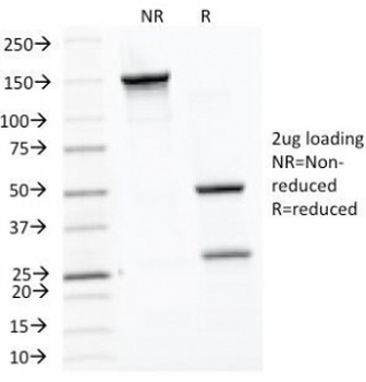 HSPD1 Antibody