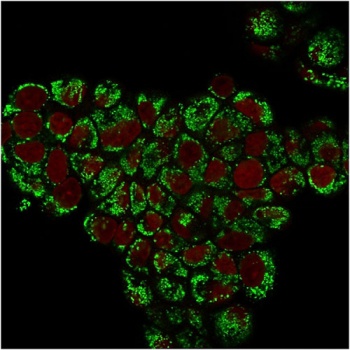 HSPD1 Antibody