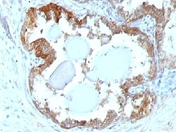 HSP27 Antibody [G3.1]