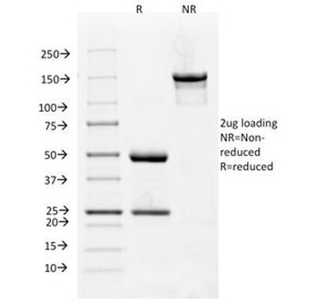 FLT1 Antibody