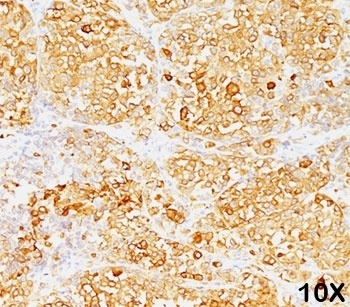 MLANA Antibody