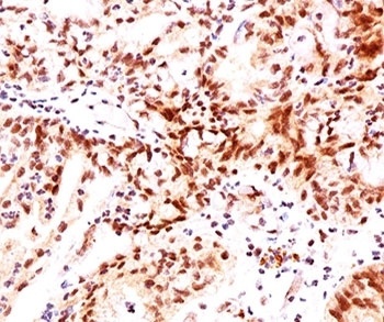 ESR2 Antibody