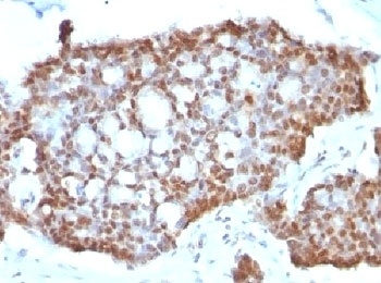 ESR2 Antibody