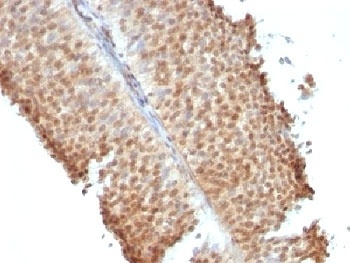 ESR2 Antibody