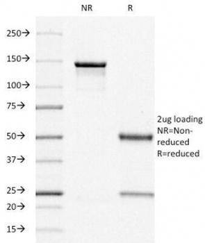 ESR1 Antibody