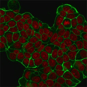 ERBB2 Antibody