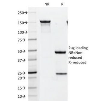 ERBB2 Antibody