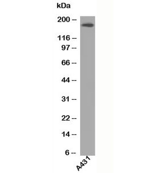 EGFR Antibody [H9B4]