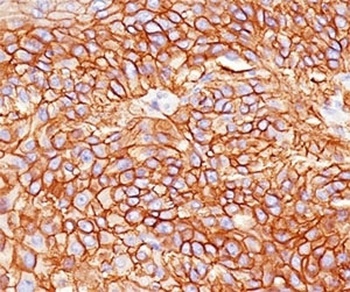 EGFR Antibody [GFR450]