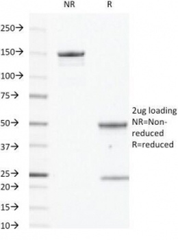 EGFR Antibody [GFR450]