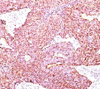 CHGA Antibody