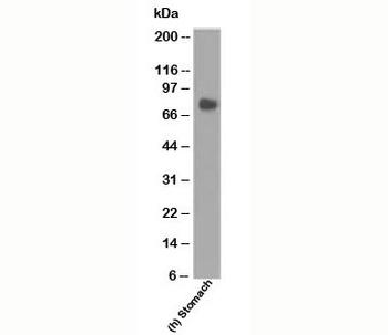 CEACAM5 Antibody