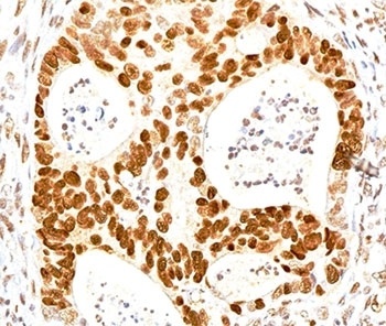 CDKN1B Antibody