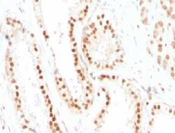 CDKN1B Antibody