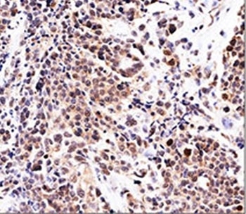 CDKN1A Antibody