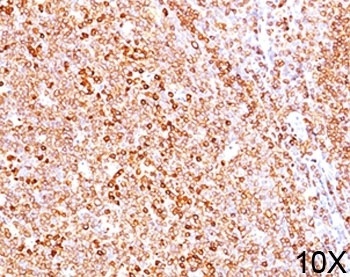 CD79A Antibody