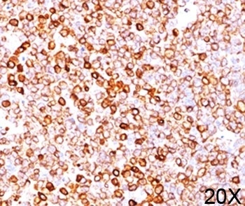 CD79A Antibody