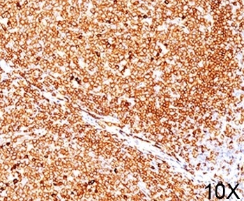 CD79A Antibody