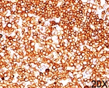 CD79A Antibody