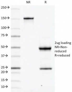 CD79A Antibody