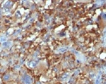 CD68 Antibody