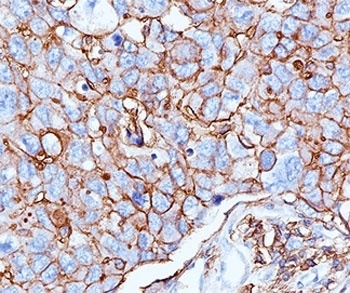 CD44 Antibody