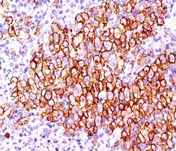 TNFRSF8 Antibody