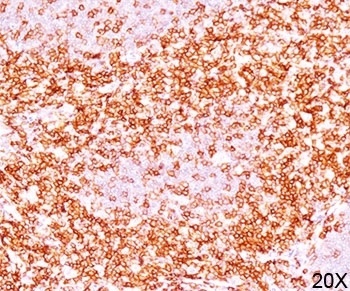CD6 Antibody