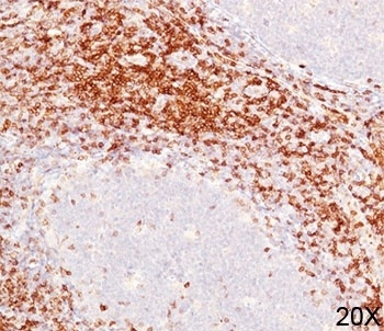 CD6 Antibody