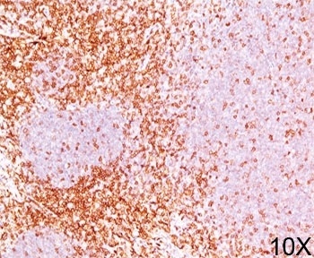 CD6 Antibody