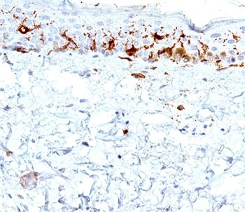 CD1A Antibody
