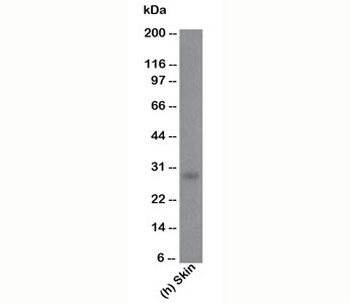 Bcl-2 Antibody [100/D5]