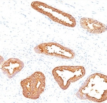 KLK3 Antibody