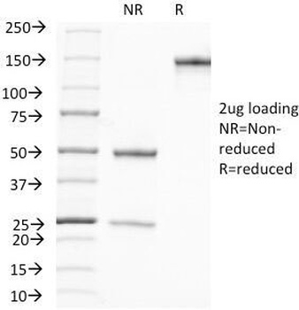 KLK3 Antibody
