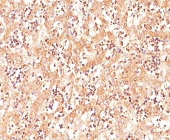 AFP Antibody
