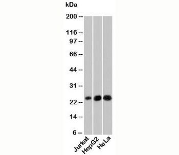 NKIRAS1 Antibody