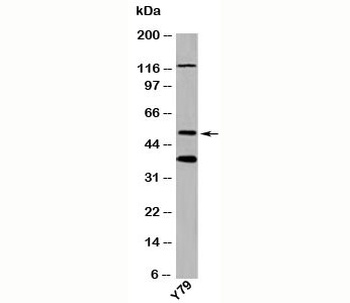 TXNIP Antibody