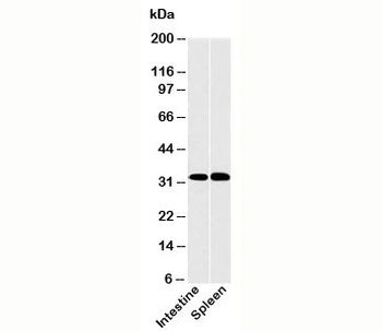 CLEC1A Antibody