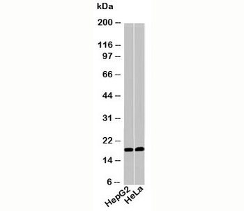 ACP1 Antibody