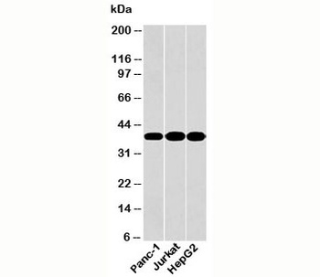 GAPDH Antibody