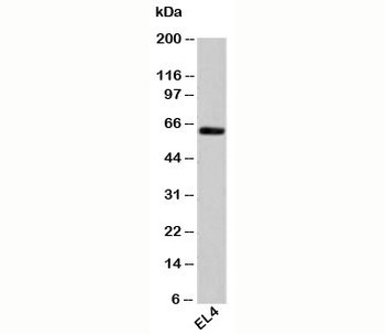 HSP60 Antibody