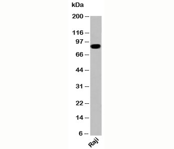 IKBKB Antibody