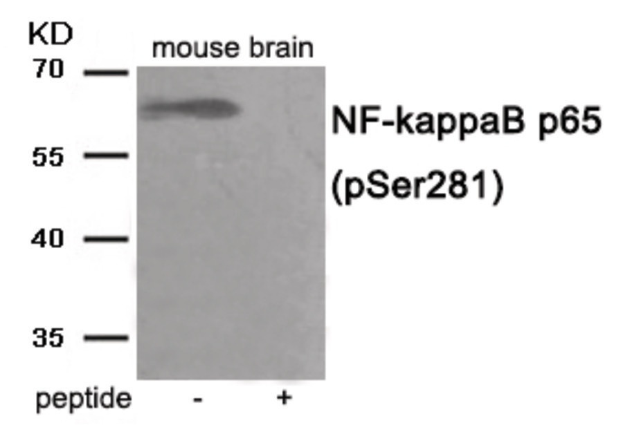 RELA Antibody