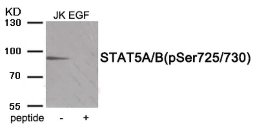 STAT5A, STAT5B Antibody