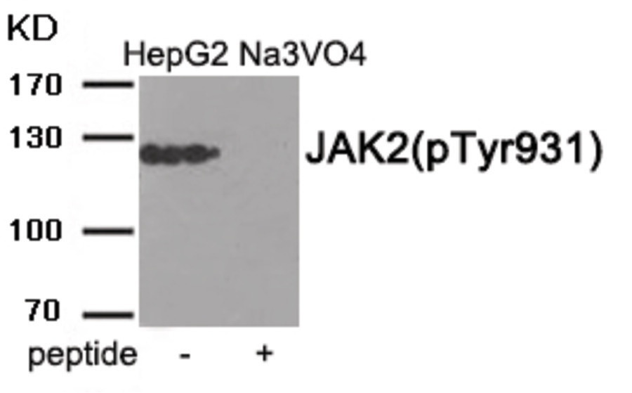ADRB2 Antibody
